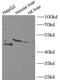 Fumarylacetoacetase antibody, FNab02948, FineTest, Western Blot image 