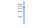 Kringle Containing Transmembrane Protein 1 antibody, GTX46606, GeneTex, Western Blot image 