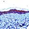 Involucrin antibody, PA5-32454, Invitrogen Antibodies, Immunohistochemistry paraffin image 