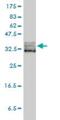 Eukaryotic Translation Initiation Factor 2 Subunit Alpha antibody, H00001965-M01, Novus Biologicals, Western Blot image 