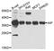 Aryl Hydrocarbon Receptor Interacting Protein antibody, A9852, ABclonal Technology, Western Blot image 