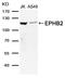 EPH Receptor B2 antibody, A01507, Boster Biological Technology, Western Blot image 