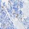 Cytochrome B-245 Beta Chain antibody, GTX00785, GeneTex, Immunohistochemistry paraffin image 