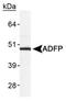 Perilipin 2 antibody, PA1-16971, Invitrogen Antibodies, Western Blot image 