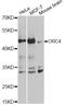 Origin Recognition Complex Subunit 4 antibody, STJ110018, St John