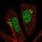 Proteasome 26S Subunit, Non-ATPase 11 antibody, HPA067433, Atlas Antibodies, Immunofluorescence image 