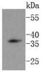 Dickkopf WNT Signaling Pathway Inhibitor 1 antibody, NBP2-67607, Novus Biologicals, Western Blot image 