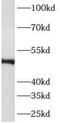 Ankyrin Repeat, SAM And Basic Leucine Zipper Domain Containing 1 antibody, FNab00653, FineTest, Western Blot image 