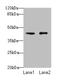 Vacuolar protein sorting-associated protein 45 antibody, CSB-PA882092LA01HU, Cusabio, Western Blot image 