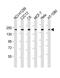 Rho Associated Coiled-Coil Containing Protein Kinase 2 antibody, M01023-1, Boster Biological Technology, Western Blot image 