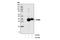 Transmembrane Protein 173 antibody, 13647S, Cell Signaling Technology, Western Blot image 