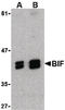 SH3 Domain Containing GRB2 Like, Endophilin B1 antibody, LS-B550, Lifespan Biosciences, Western Blot image 