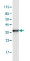 Prolyl 3-Hydroxylase 1 antibody, H00064175-M02, Novus Biologicals, Western Blot image 