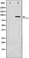 PKC antibody, orb106386, Biorbyt, Western Blot image 