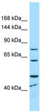 Microcephalin 1 antibody, TA343341, Origene, Western Blot image 