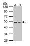 Protein Kinase CAMP-Dependent Type II Regulatory Subunit Beta antibody, GTX105558, GeneTex, Western Blot image 