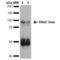 Sodium Channel Epithelial 1 Beta Subunit antibody, M01670, Boster Biological Technology, Western Blot image 