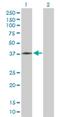 ADP-Ribosyltransferase 5 antibody, H00116969-B02P, Novus Biologicals, Western Blot image 