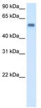 Monoamine Oxidase B antibody, TA332355, Origene, Western Blot image 