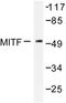 Melanocyte Inducing Transcription Factor antibody, LS-C176425, Lifespan Biosciences, Western Blot image 