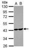 Aldolase, Fructose-Bisphosphate C antibody, GTX102284, GeneTex, Western Blot image 