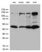 Inhibitor Of Nuclear Factor Kappa B Kinase Regulatory Subunit Gamma antibody, LS-C796361, Lifespan Biosciences, Western Blot image 