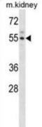 Activin A Receptor Type 2A antibody, abx028450, Abbexa, Western Blot image 