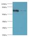 DExH-Box Helicase 58 antibody, MBS1495933, MyBioSource, Western Blot image 