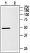 Gamma-Aminobutyric Acid Type A Receptor Alpha1 Subunit antibody, PA5-77400, Invitrogen Antibodies, Western Blot image 