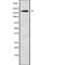 ATP Binding Cassette Subfamily A Member 10 antibody, abx147860, Abbexa, Western Blot image 