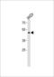 Transcription Factor Dp Family Member 3 antibody, 60-081, ProSci, Western Blot image 