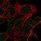 Homeobox D11 antibody, NBP2-58044, Novus Biologicals, Immunofluorescence image 