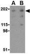 Reticulon 4 antibody, GTX85447, GeneTex, Western Blot image 