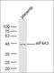 Eukaryotic Translation Initiation Factor 4A3 antibody, orb183348, Biorbyt, Western Blot image 