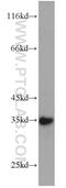 Sulfotransferase Family 1C Member 2 antibody, 10662-1-AP, Proteintech Group, Western Blot image 