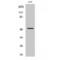 Carboxypeptidase M antibody, LS-C382882, Lifespan Biosciences, Western Blot image 