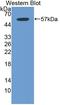 Integrin Subunit Beta 6 antibody, LS-C374326, Lifespan Biosciences, Western Blot image 