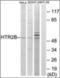 Peroxisome Proliferator Activated Receptor Gamma antibody, orb313882, Biorbyt, Western Blot image 