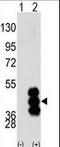 Phosphorylase Kinase Catalytic Subunit Gamma 2 antibody, LS-C100763, Lifespan Biosciences, Western Blot image 