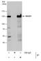 RAD21 Cohesin Complex Component antibody, PA5-28344, Invitrogen Antibodies, Immunoprecipitation image 