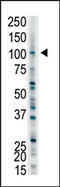 Ubiquitin Protein Ligase E3A antibody, AP12054PU-N, Origene, Western Blot image 