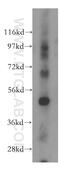 COP9 Signalosome Subunit 3 antibody, 15577-1-AP, Proteintech Group, Western Blot image 