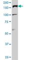 DNA Topoisomerase II Alpha antibody, H00007153-M01, Novus Biologicals, Western Blot image 