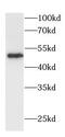 DEAD-Box Helicase 25 antibody, FNab10413, FineTest, Western Blot image 