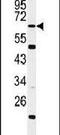 WD And Tetratricopeptide Repeats 1 antibody, PA5-24869, Invitrogen Antibodies, Western Blot image 