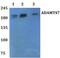 ADAM Metallopeptidase With Thrombospondin Type 1 Motif 7 antibody, PA5-75869, Invitrogen Antibodies, Western Blot image 