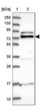 Zinc Finger And BTB Domain Containing 7A antibody, NBP2-38550, Novus Biologicals, Western Blot image 