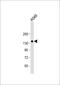 Transmembrane Serine Protease 15 antibody, 56-304, ProSci, Western Blot image 