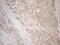 Insulin Like Growth Factor Binding Protein 1 antibody, NBP2-46039, Novus Biologicals, Immunohistochemistry frozen image 
