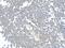 DNA Damage Inducible Transcript 3 antibody, A00311-2, Boster Biological Technology, Immunohistochemistry paraffin image 